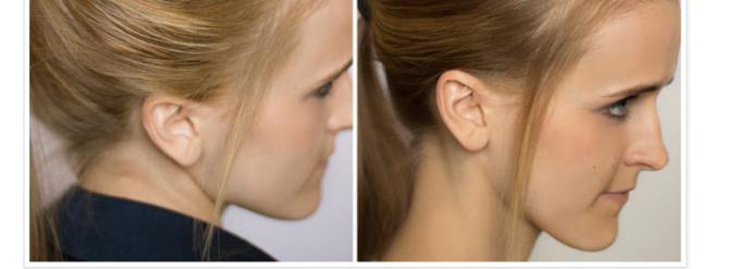 Ponytail Hairstyles Steps7 - 8 B